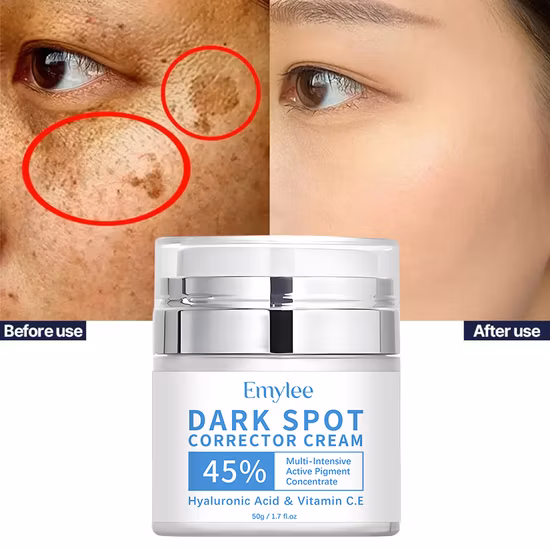 Private Label Dark Spot Remover TCA Anti-Falten-Serum Säure-Melasma-Peeling